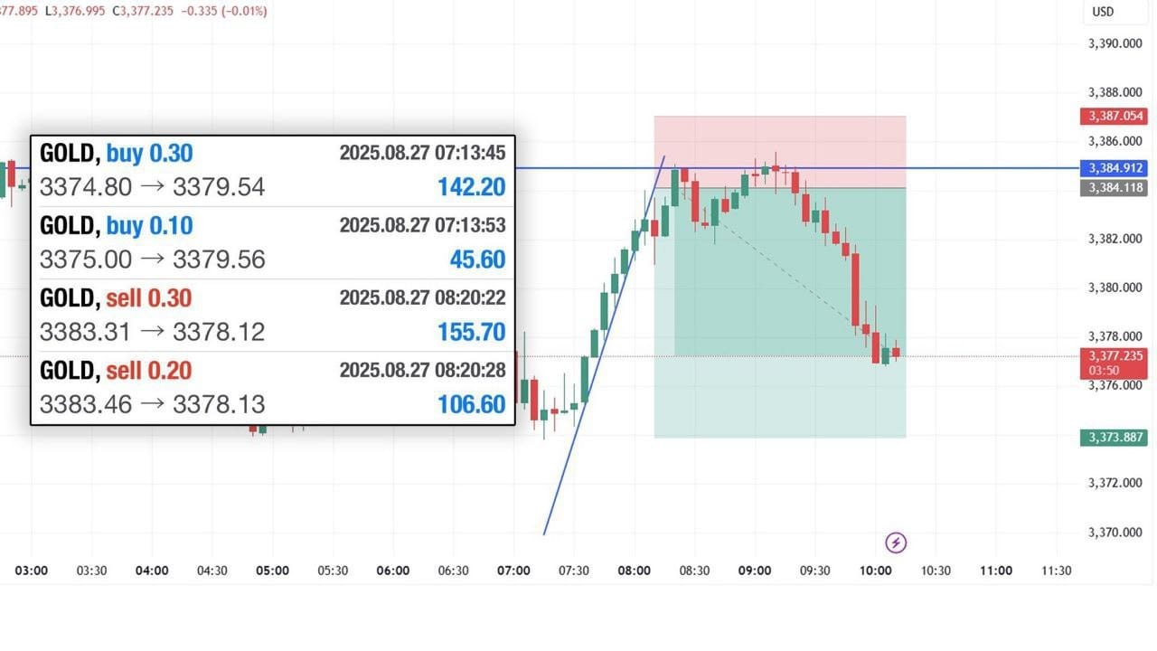 XAUUSD VIP SIGNALS