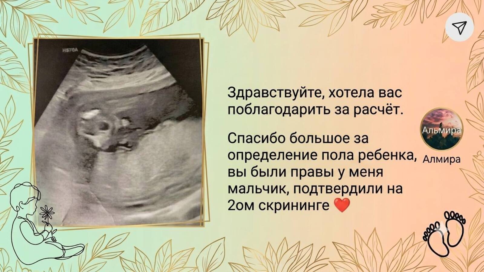 Планирование пола ребенка 👶